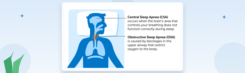 What Is Central Sleep Apnea? Causes, Symptoms & Treatment