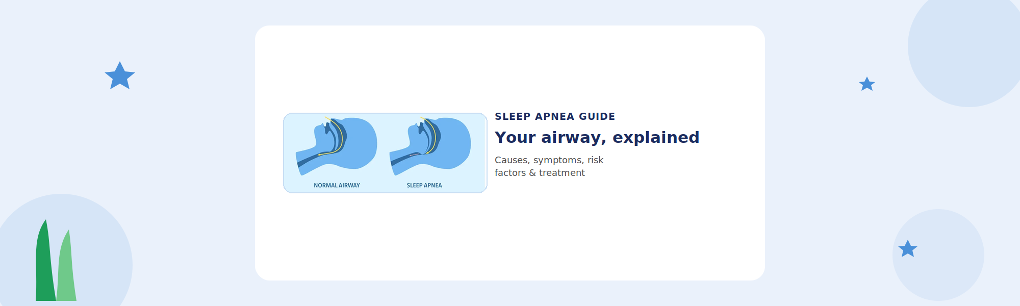 Obstructive Sleep Apnea: Causes, Symptoms, Risk Factors & Treatment