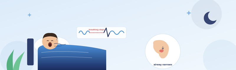 What Is Sleep Apnea? Symptoms, Causes & Treatment